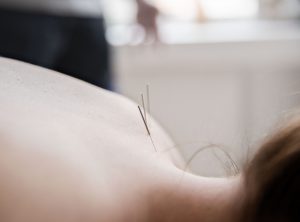 Agilokliniken Akupunktur behandling Stockholm